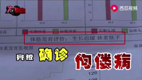 湖南“大頭娃娃”事件 湖南“大頭娃娃”事件