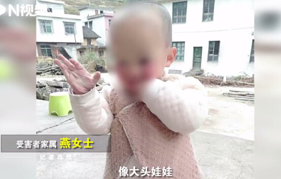 湖南“大頭娃娃”事件 湖南“大頭娃娃”事件